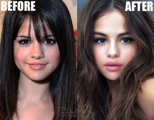 A picture of Selena Gomez before and after.